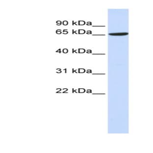 anti-ADAM Metallopeptidase Domain 9 (ADAM9) (Middle Region) antibody avatar
