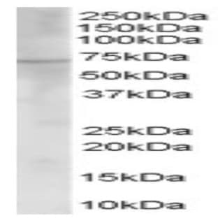 anti-Choline O-Acetyltransferase (CHAT) (C-Term) antibody avatar