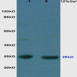 anti-Cytochrome C Oxidase Subunit II (COX2) antibody avatar