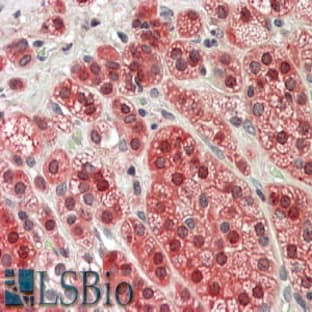 anti-5-Methyltetrahydrofolate-Homocysteine Methyltransferase (MTR) (C-Term) antibody