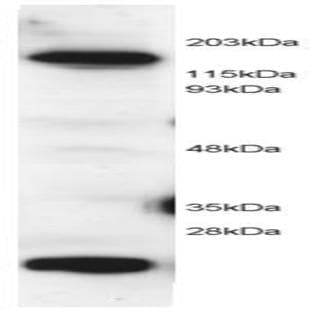 anti-5-Methyltetrahydrofolate-Homocysteine Methyltransferase (MTR) (C-Term) antibody