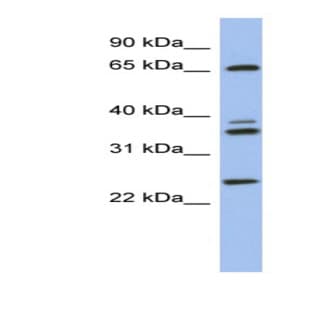 anti-ATPase, H+ Transporting, Lysosomal 70kDa, V1 Subunit A (ATP6V1A) (N-Term) antibody avatar