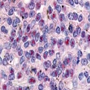 anti-Cyclin L1 (CCNL1) (AA 314-369), (Isoform 1) antibody avatar