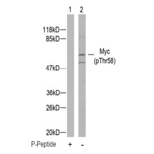 anti-V-Myc Myelocytomatosis Viral Oncogene Homolog (Avian) (MYC) (pThr58) antibody avatar