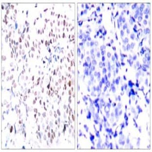 anti-V-Myc Myelocytomatosis Viral Oncogene Homolog (Avian) (MYC) (pThr358) antibody avatar