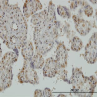 anti-Activating Transcription Factor 3 (ATF3) (AA 1-182) antibody avatar
