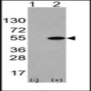 anti-Activating Transcription Factor 4 (Tax-Responsive Enhancer Element B67) (ATF4) (Ser245) antibody avatar