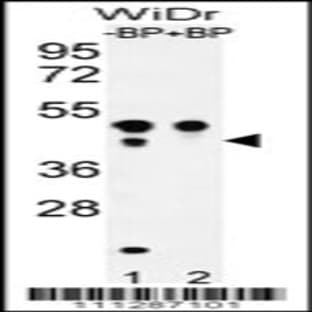 anti-Activating Transcription Factor 4 (Tax-Responsive Enhancer Element B67) (ATF4) (AA 220-252), (Ser245) antibody avatar