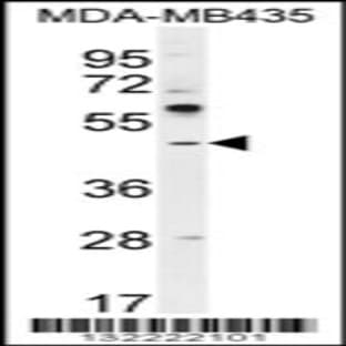 anti-Activating Transcription Factor 4 (Tax-Responsive Enhancer Element B67) (ATF4) (AA 171-198), (Center) antibody avatar