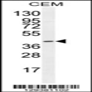 anti-Coagulation Factor VIII-Associated 2 (F8A2) (N-Term), (AA 12-40) antibody avatar
