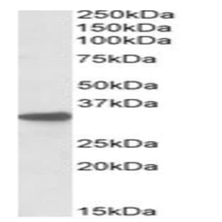 anti-Cytochrome B5 Reductase 3 (CYB5R3) (C-Term) antibody avatar