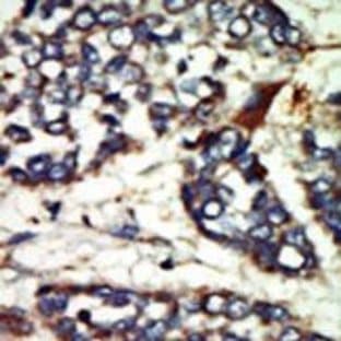 anti-NIMA-Related Kinase 1 (NEK1) (C-Term), (AA 1173-1202) antibody avatar