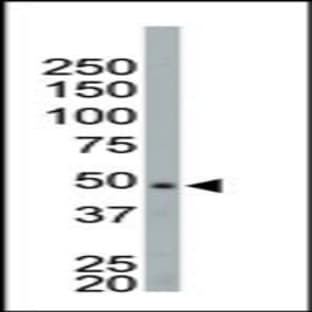 anti-NIMA (Never in Mitosis Gene A)-Related Kinase 2 (NEK2) (Middle Region) antibody avatar