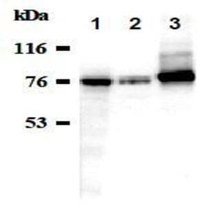 anti-ATPase, Na+/K+ Transporting, alpha 1 Polypeptide (ATP1A1) antibody avatar