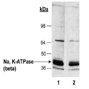 anti-ATPase, Na+/K+ Transporting, beta 1 Polypeptide (ATP1B1) antibody avatar