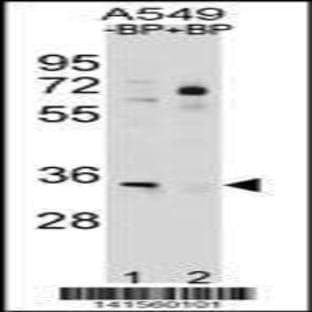 anti-ATPase, Na+/K+ Transporting, beta 2 Polypeptide (ATP1B2) (C-Term), (AA 247-276) antibody avatar
