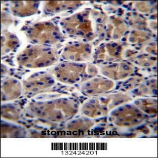 anti-ATPase, Na+/K+ Transporting, beta 3 Polypeptide (ATP1B3) (C-Term), (AA 241-270) antibody avatar