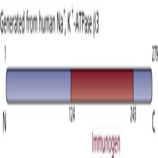 anti-ATPase, Na+/K+ Transporting, beta 3 Polypeptide (ATP1B3) (AA 124-243) antibody avatar