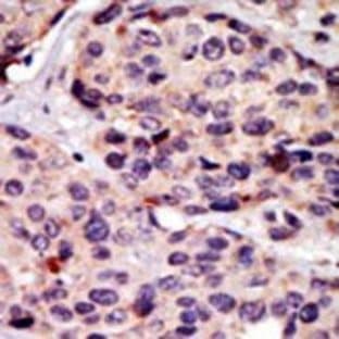 anti-Atrial Natriuretic Peptide Receptor 3 (NPR3) (N-Term) antibody avatar