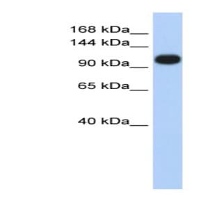 anti-ATPase, Ca++ Transporting, Ubiquitous (ATP2A3) (Middle Region) antibody avatar