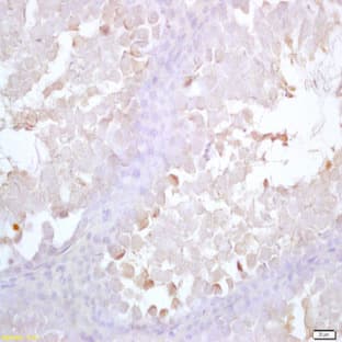 anti-Acrosin (ACR) antibody