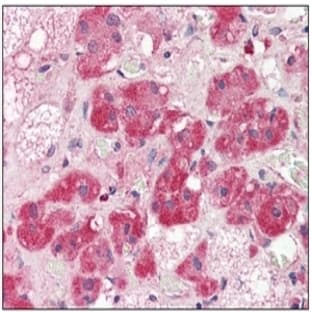 anti-5'-Nucleotidase, Ecto (CD73) (NT5E) (AA 27-252) antibody avatar