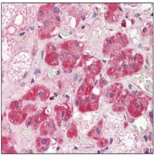 anti-5'-Nucleotidase, Ecto (CD73) (NT5E) (AA 27-252) antibody avatar