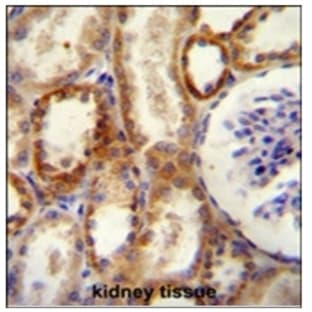 anti-5'-Nucleotidase, Ecto (CD73) (NT5E) (N-Term), (AA 1-30) antibody