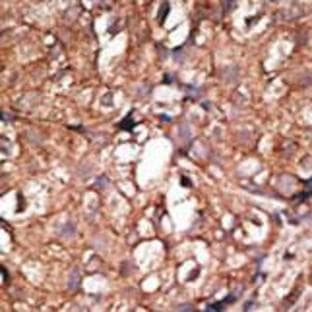 anti-5'-Nucleotidase, Ecto (CD73) (NT5E) (C-Term) antibody