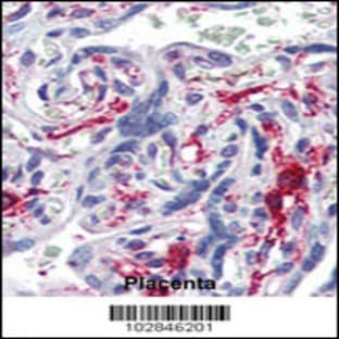 anti-5'-Nucleotidase, Ecto (CD73) (NT5E) (C-Term), (AA 520-550) antibody