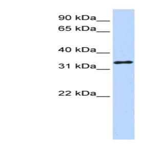 anti-3-hydroxyanthranilate 3,4-Dioxygenase (HAAO) (N-Term) antibody avatar