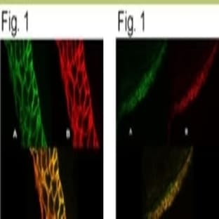 anti-ATPase, Ca++ Transporting, Plasma Membrane 4 (ATP2B4) (AA 51-75) antibody avatar