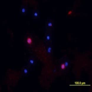 anti-CD8 Antigen, alpha Polypeptide (CD8A) antibody avatar