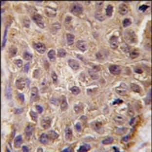 anti-2',5'-Oligoadenylate Synthetase 1, 40/46kDa (OAS1) (C-Term) antibody avatar