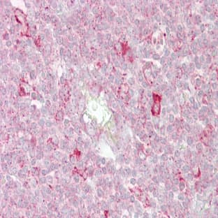 anti-2',5'-Oligoadenylate Synthetase 1, 40/46kDa (OAS1) (C-Term) antibody avatar