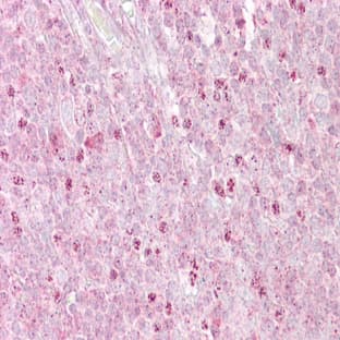 anti-2',5'-Oligoadenylate Synthetase 1, 40/46kDa (OAS1) (C-Term) antibody avatar