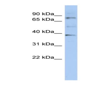 anti-2'-5'-Oligoadenylate Synthetase 2, 69/71kDa (OAS2) (N-Term) antibody avatar