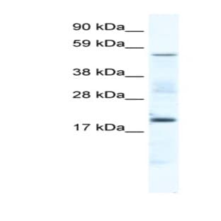 anti-Casein Kinase 1, gamma 1 (CSNK1G1) (Middle Region) antibody avatar