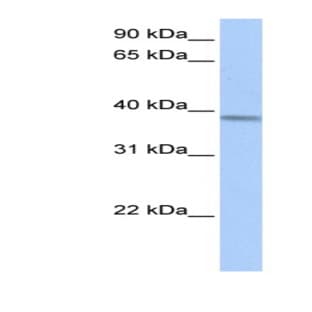 anti-Acyl-CoA Dehydrogenase, Short/branched Chain (ACADSB) (Middle Region) antibody avatar