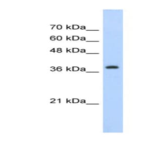 anti-Chromobox Homolog 6 (CBX6) (C-Term) antibody avatar