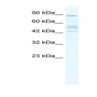 anti-Cholinergic Receptor, Nicotinic, beta 2 (Neuronal) (CHRNB2) (Middle Region) antibody avatar