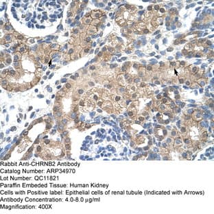 anti-Cholinergic Receptor, Nicotinic, beta 2 (Neuronal) (CHRNB2) (Middle Region) antibody avatar