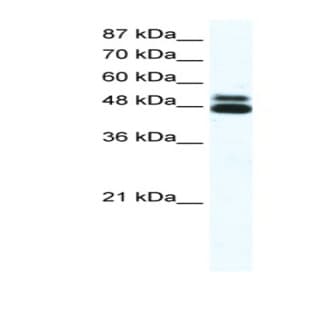 anti-Cholinergic Receptor, Nicotinic, beta 2 (Neuronal) (CHRNB2) (N-Term) antibody avatar