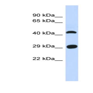 anti-Chromosome 4 Open Reading Frame 22 (C4orf22) (N-Term) antibody avatar