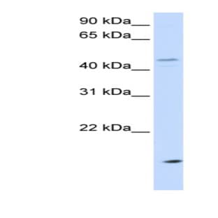 anti-Cholesteryl Ester Transfer Protein (CETP) (N-Term) antibody avatar
