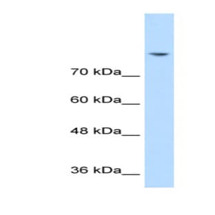 anti-Discs, Large Homolog 2 (Drosophila) (DLG2) (N-Term) antibody