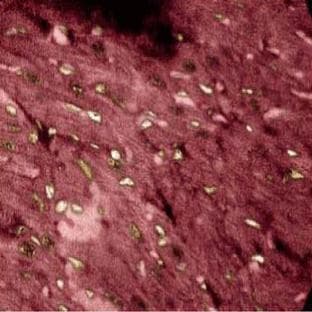 anti-A Kinase (PRKA) Anchor Protein 11 (AKAP11) (AA 11-173) antibody avatar