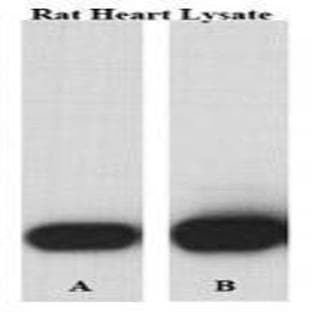 anti-Aconitase 2, Mitochondrial (ACO2) (Center) antibody avatar