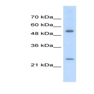 anti-Adenylate Kinase 4 (AK4) (Middle Region) antibody avatar