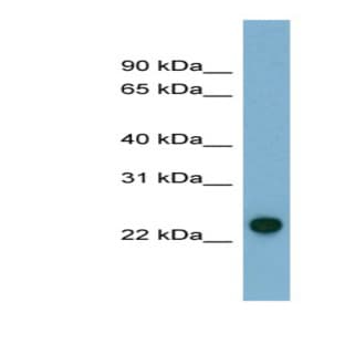 anti-Adenylate Kinase 3 (AK3) (N-Term) antibody avatar